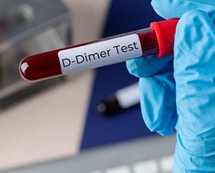 blogd-dimer-test