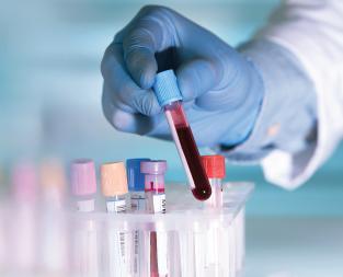 blogwhat-is-a-creatinine-test
