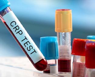 blog/what-is-a-crp-test