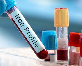 blog/what-is-iron-profile-test