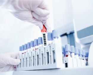 blogwhat-is-hba1c-test