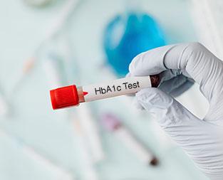 blog/hba1c-test-definition-purpose-and-significance