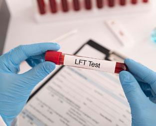 blog/understanding-the-basics-of-liver-function-tests